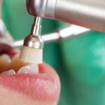 Affordable Dental Plans for Every Budget