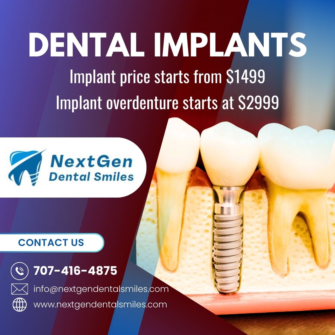 dental implants current offers